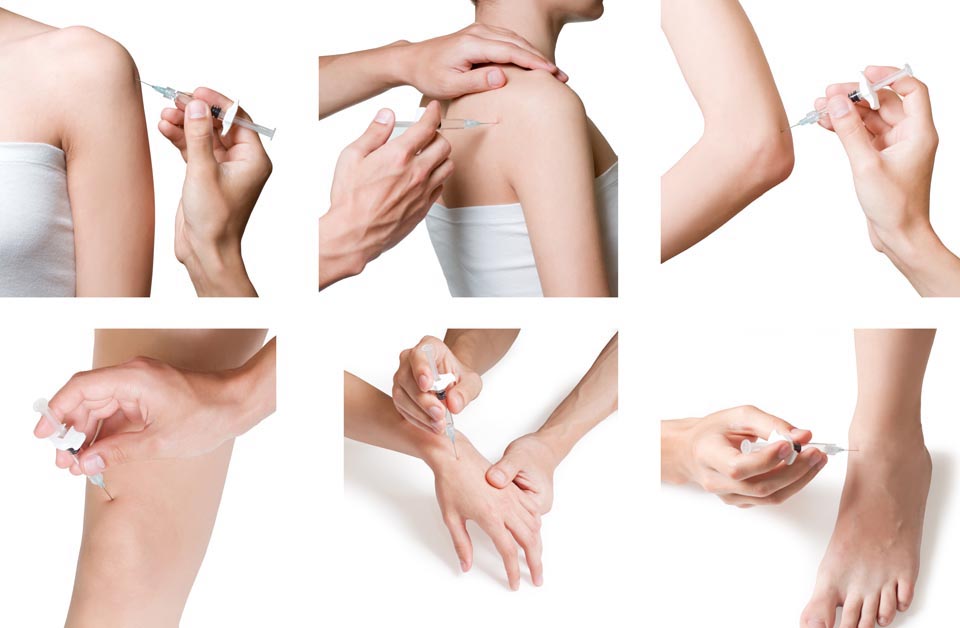 Joint Injections | Innovative Medicine Tucson, AZ